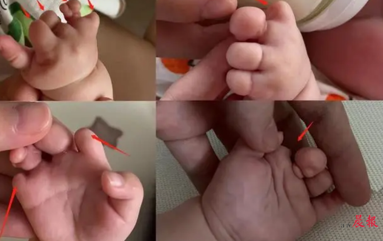 重庆备孕试管