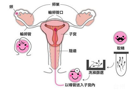 事业编小产
