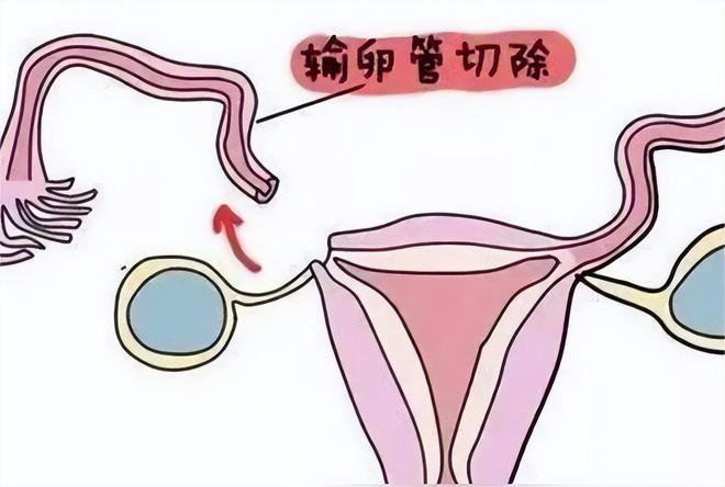 事业编小产