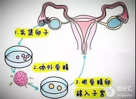 买的房子七十年产权到期后怎么办